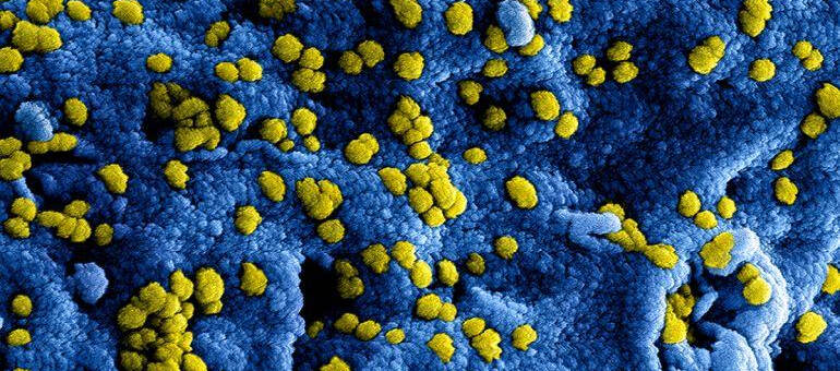 Coronavirus onder microscoop